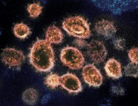 Coronavirus’s impact on Egypt’s economy 1