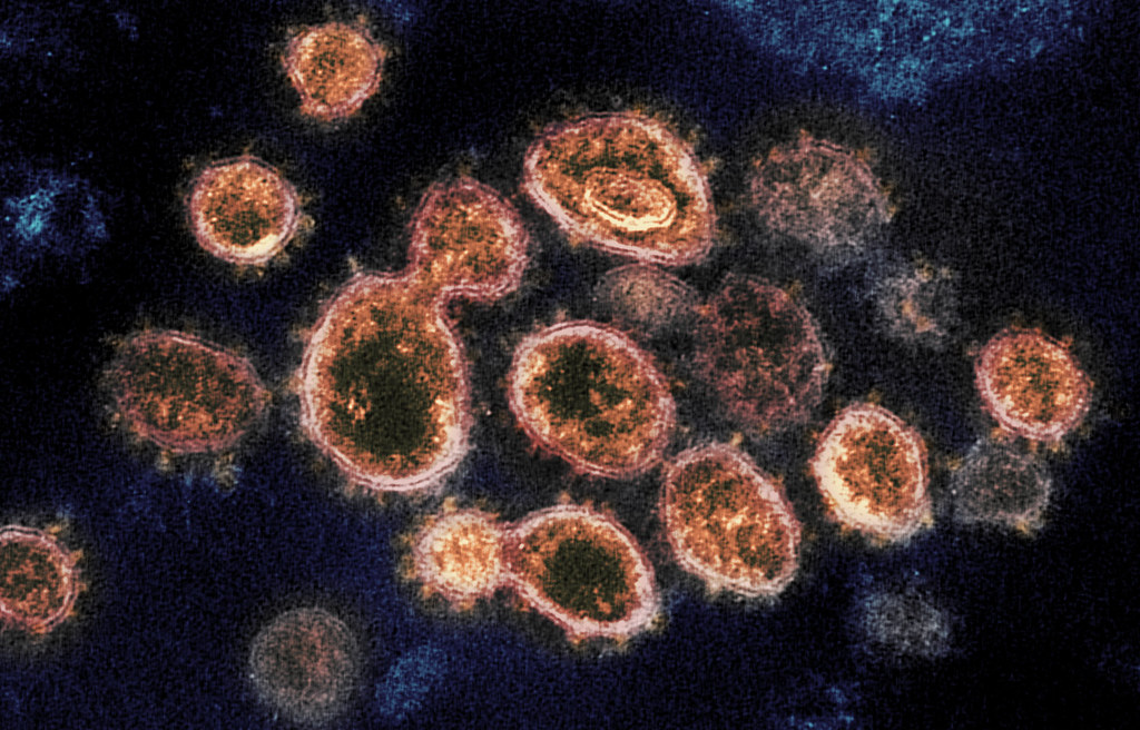 Coronavirus’s impact on Egypt’s economy 1