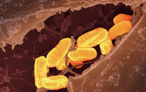 national institute of allergy and infectious diseases tjTKY kz gg unsplash