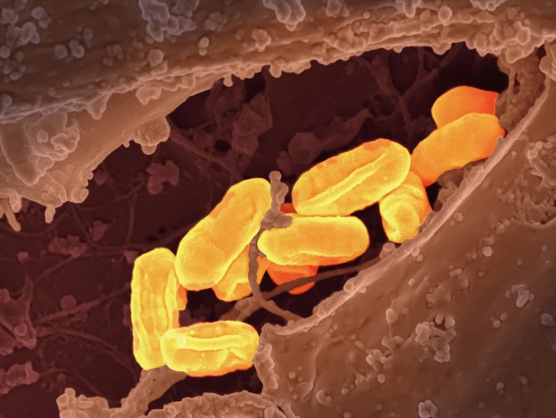 national institute of allergy and infectious diseases tjTKY kz gg unsplash